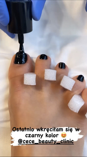 Katarzyna Cichopek feet photo thumbnail