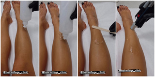 Katarzyna Cichopek feet photo thumbnail