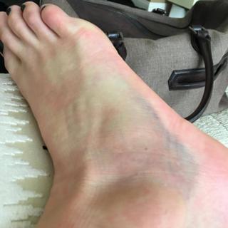 Kate Upton feet photo thumbnail