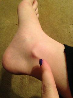 Kate Witcher feet photo 10