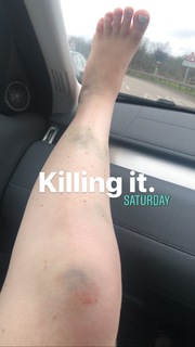 Katherine Ryan feet photo thumbnail