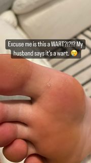 Katherine Ryan feet photo thumbnail