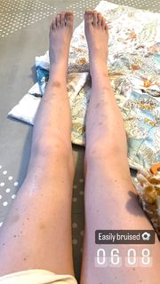Katherine Ryan feet photo thumbnail