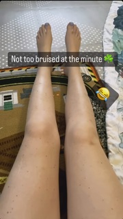 Katherine Ryan feet photo thumbnail