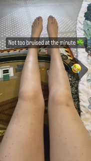 Katherine Ryan feet photo thumbnail