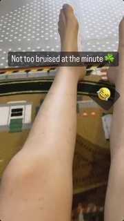 Katherine Ryan feet photo thumbnail