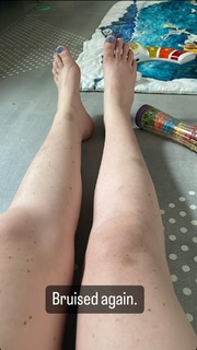 Katherine Ryan feet photo thumbnail