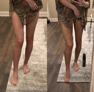 Katherine Webb feet photo thumbnail