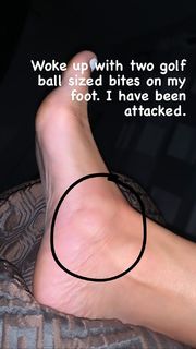 Kayla Becker feet photo thumbnail