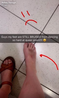 Kelsey Darragh feet photo 15
