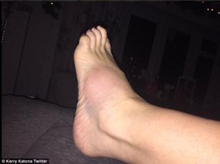 Kerry Katona feet photo thumbnail