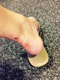 Kirsty Gallacher feet photo thumbnail