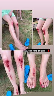 Kristina Asmus feet photo thumbnail