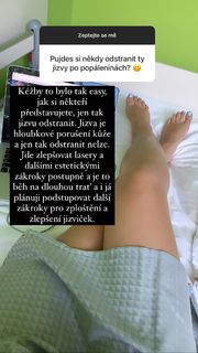 Kristýna Tresnáková feet photo 2