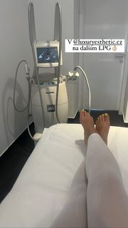 Kristýna Tresnáková feet photo 7