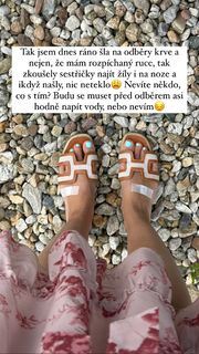 Kristýna Tresnáková feet photo 12