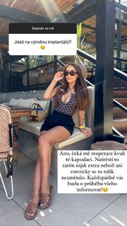 Kristýna Tresnáková feet photo 7