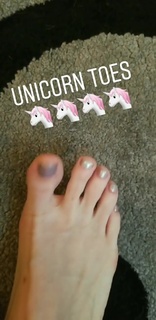 Kyle Unfug feet photo thumbnail