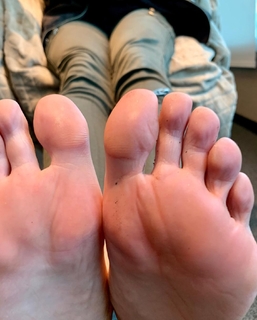 Kyle Unfug feet photo thumbnail