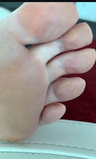 Kyle Unfug feet photo thumbnail