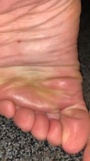 Kyle Unfug feet photo thumbnail