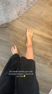 Laura Escanes feet photo 1