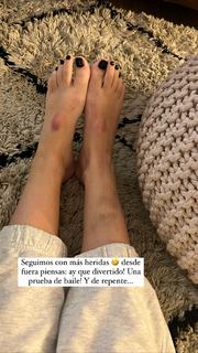 Laura Escanes feet photo 20