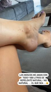 Laura González feet photo thumbnail