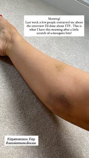 Laura Hamilton feet photo thumbnail