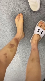 Lauren Williams feet photo 7