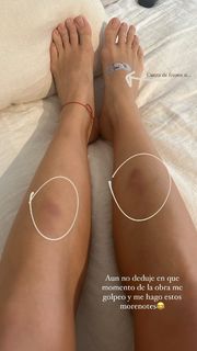 Laurita Fernández feet photo 9