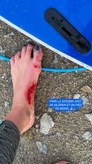 Laury Thilleman feet photo thumbnail