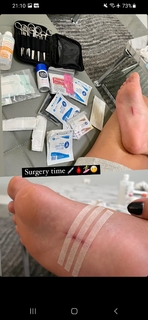 Letícia Bufoni feet photo thumbnail