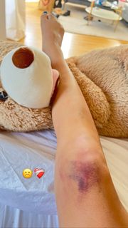 Lily Chee feet photo thumbnail