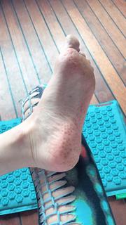 Lindell Nuyttens feet photo thumbnail