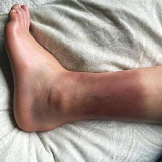 Lindsey Vonn feet photo thumbnail