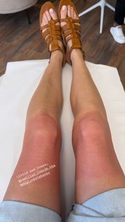 Lisa Snowdon feet photo thumbnail
