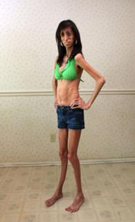 Lizzie Velasquez feet photo 10