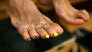 Lizzie Velasquez feet photo 6