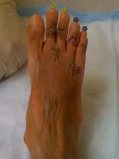 Lizzie Velasquez feet photo 2