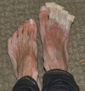 Lizzie Velasquez feet photo 1