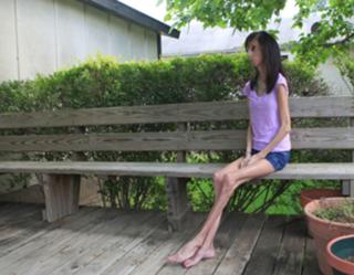 Lizzie Velasquez feet photo 19