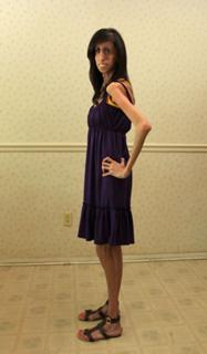 Lizzie Velasquez feet photo 18