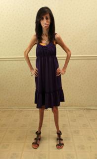 Lizzie Velasquez feet photo 17