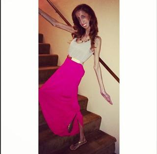 Lizzie Velasquez feet photo 16