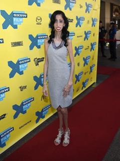 Lizzie Velasquez feet photo 14