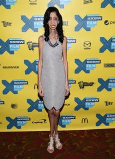 Lizzie Velasquez feet photo 12
