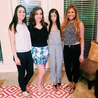 Lizzie Velasquez feet photo 11