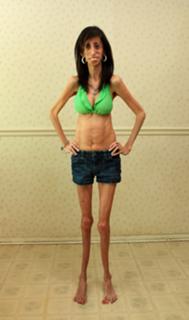Lizzie Velasquez feet photo 7