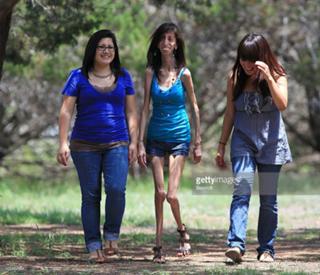 Lizzie Velasquez feet photo 19